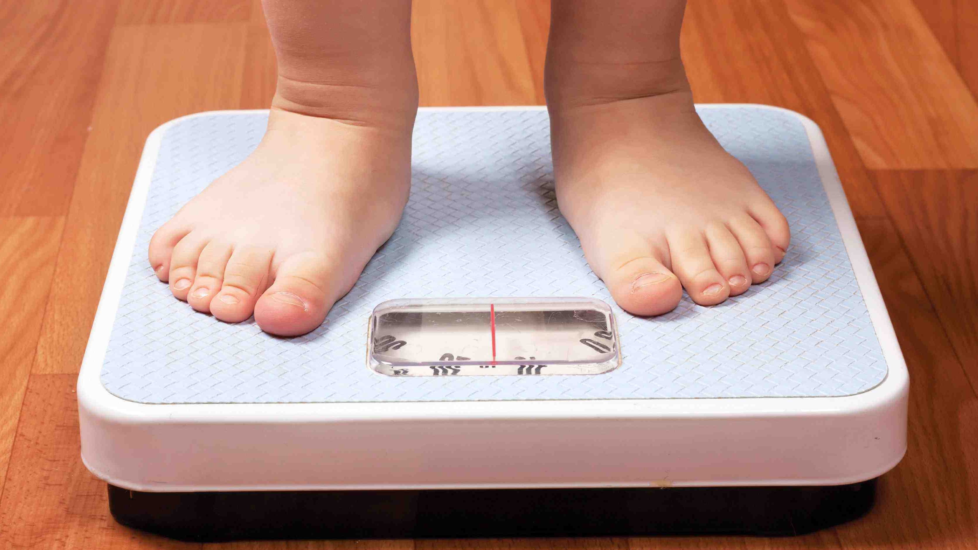 La obesidad ha llegado a considerarse una epidemia de Salud. Fuente: Juventud Rebelde