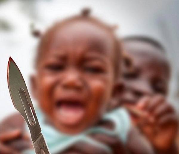 Mutilación genital femenina podría crecer para 2030 - Juventud Rebelde