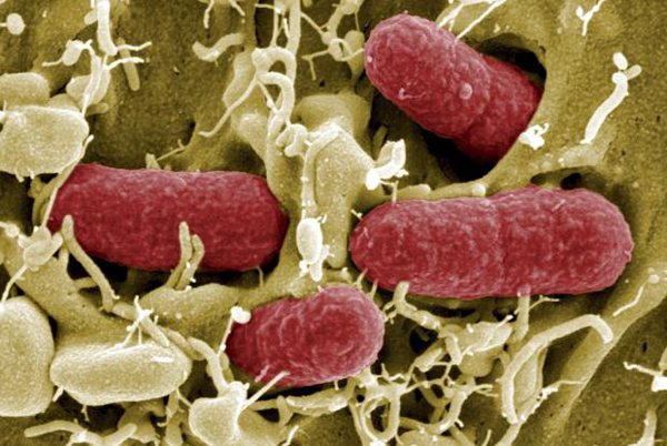 bacteria Escherichia coli enterohemorrágica (ECEH)