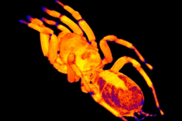 Cuerpo de una tarántula