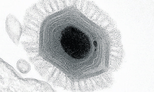 Megavirus chilensis