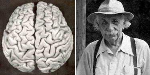 Cerebro de Albert Einstein