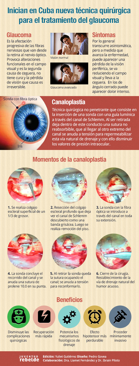 Glaucoma