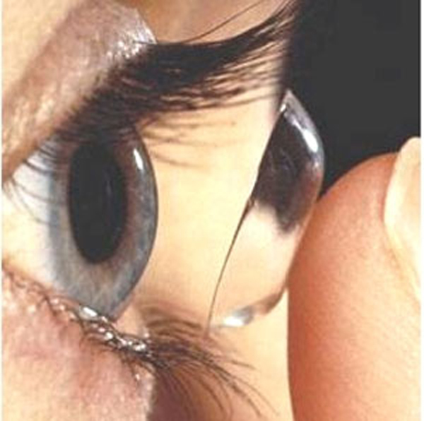 Lentes de contacto