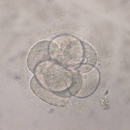 Embriones