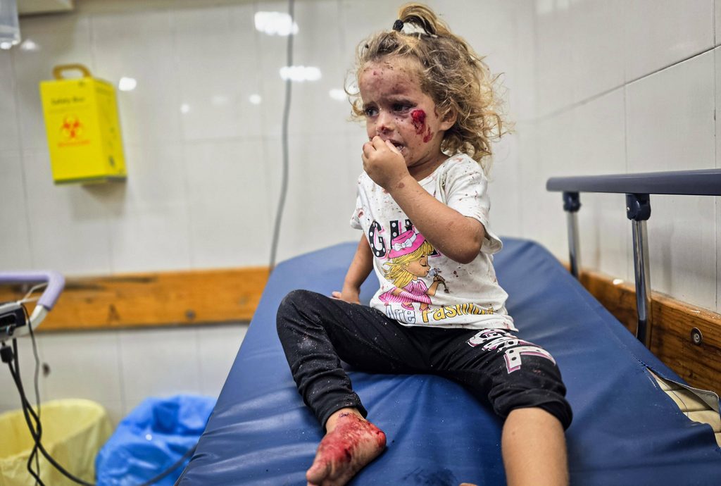 Un niño palestino herido en un ataque aéreo israelí contra la zona de al-Mawasi, en Jan Yunis, el 5 de octubre de 2026. Foto: APA Images vía Reuters