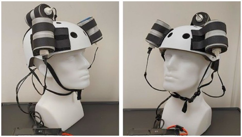 Reducen tumor cerebral terminal mediante un casco