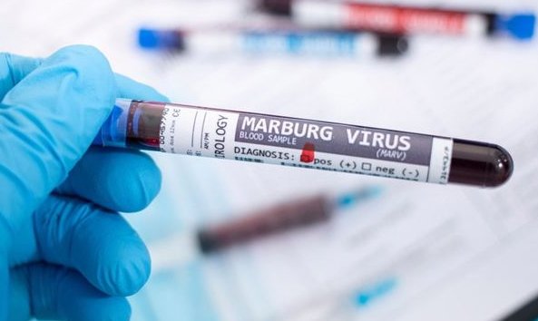 Virus de Marburgo