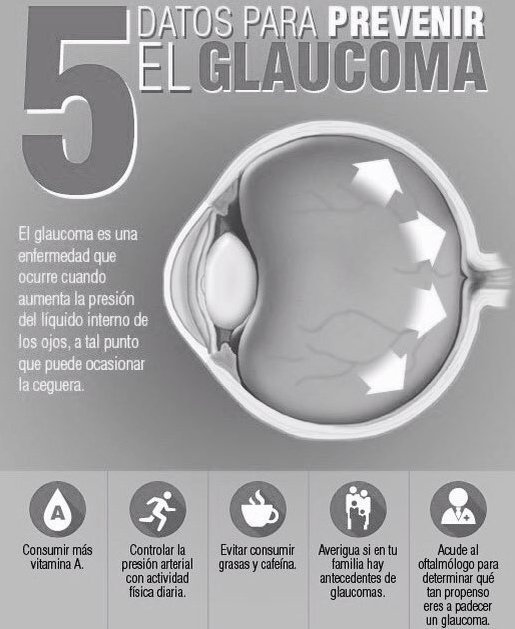 Hay mayor riesgo de padecer glaucoma en mayores de 40 años