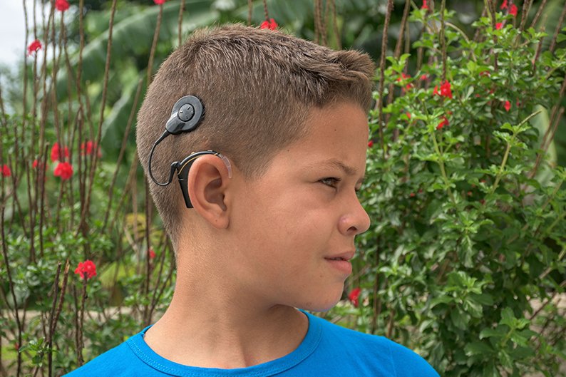 El Programa Cubano de Implantes Cocleares, por ejemplo, con más de 25 años de creado, ha permitido devolver la audición a cientos de personas con discapacidad auditiva profunda.