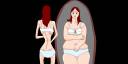 Anorexia y bulimia