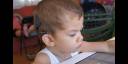 Cuba ha realizado 360 implantes cocleares, la mayoría a niños, todos con muy buenos resultados y de ese total 30 pacientes son sordociegos