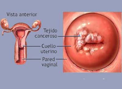 Cuello uterino