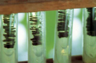 Chlorella vulgaris
