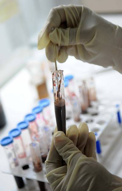 Se han analizado más de 250 muestras de sangre