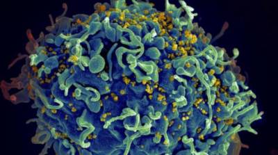 Célula T humana está siendo atacada por el VIH