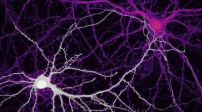 neuronas cultivadas de hipocampos de ratones