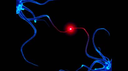 Subred de neuronas