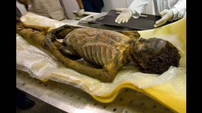 La momia más antigua con aterosclerosis