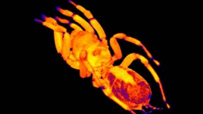 Cuerpo de una tarántula