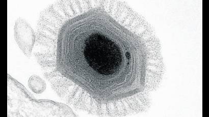 Megavirus chilensis