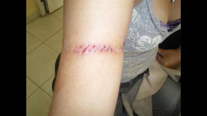 Tatuaje 