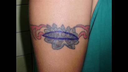 Tatuaje 