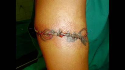 Tatuaje 