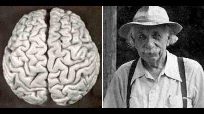 Cerebro de Albert Einstein