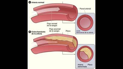 Arterias