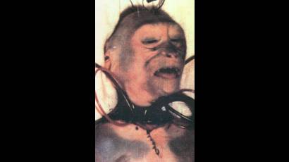 Transplante de cabeza de un mono