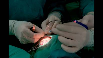 Cuba inicia nueva cirugía en el tratamiento del glaucoma