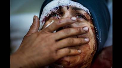 El rostro de Siria