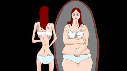 Anorexia y bulimia