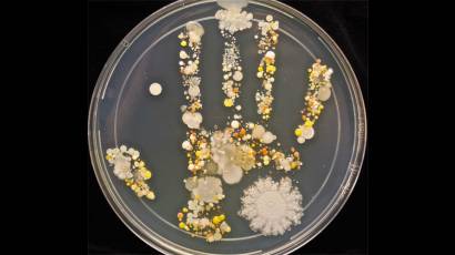 Microorganismos en las manos