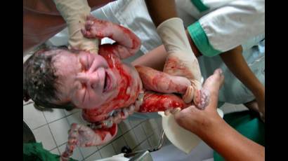 Cero mortalidad infantil en Plan Turquino espirituano