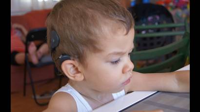 Cuba ha realizado 360 implantes cocleares, la mayoría a niños, todos con muy buenos resultados y de ese total 30 pacientes son sordociegos