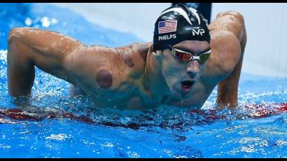 Las manchas circulares en el cuerpo del nadador estadounidense Michael Phelps despertaron la curiosidad mediática