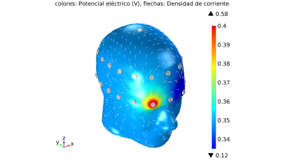 Un modelo computacional de cabeza humana a partir de elementos finitos les ha permitido obtener alentadores resultados en el diagnóstico diferencial de enfermedades cerebrovasculares. 