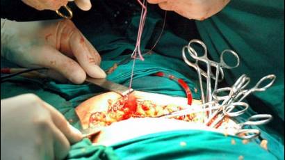 Transplante de órganos en Cuba