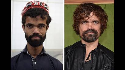 El gemelo de Tyrion Lannister