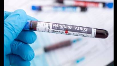 Virus de Marburgo