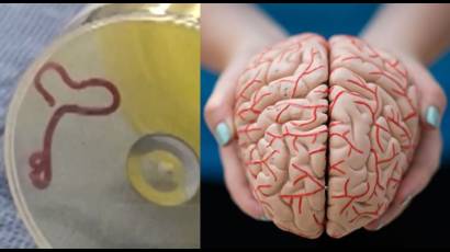 Escalofriante descubrimiento: identifican primer gusano parásito en cerebro humano