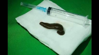 Médicos creen que al llevar las hojas sin lavar hasta la boca, permitió que una pequeña sanguijuela accediera a su cuerpo