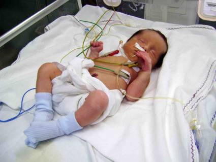 Médicos matanceros salvan bebé