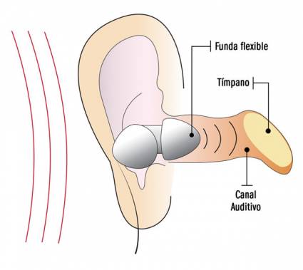 Audífonos intrauditivos