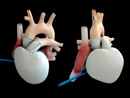 Corazón artificial