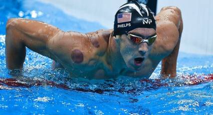 Las manchas circulares en el cuerpo del nadador estadounidense Michael Phelps despertaron la curiosidad mediática