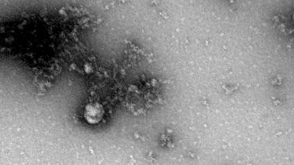 Foto de la nueva variante de coronavirus