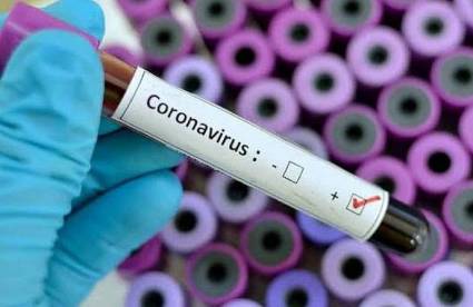 OMS sobre coronavirus sugiere: Evitar contacto directo con personas enfermas